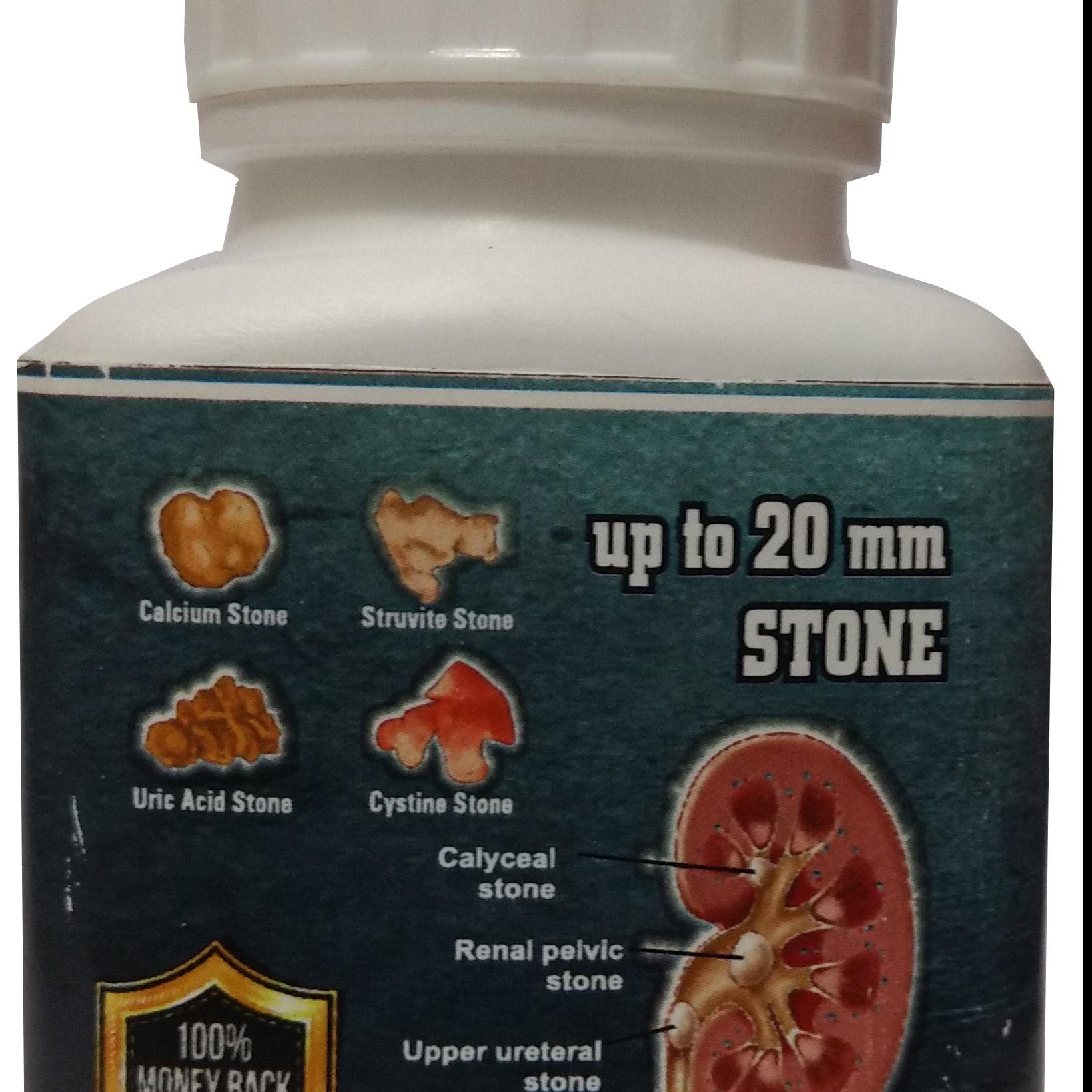 Ayurvedic  Stone Crusher Remove Kidney Stone fast -Pharmascience
