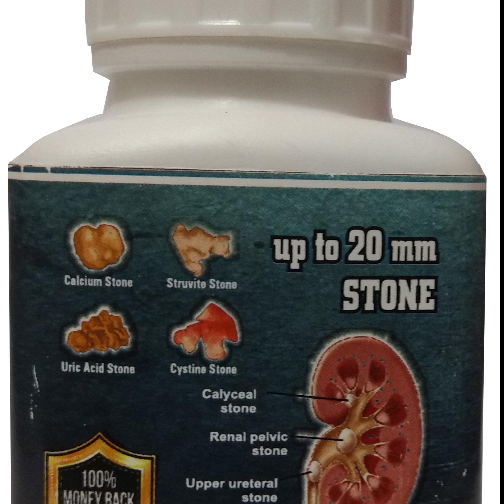Kidney Stone Diluter and  Remover by Stone Crusher.-Pharmascience