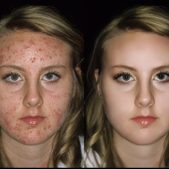 Photo Retouching -Workites Technology LLP