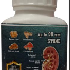 100% remove Kidney Stone by Stone Crusher